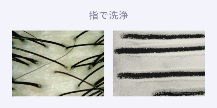 指で洗浄
