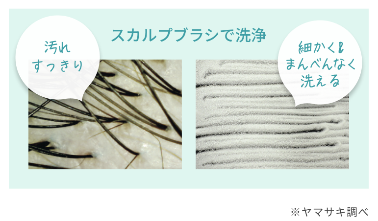 スカルプブラシで洗浄  汚れすっきり  細かく&まんべんなく洗える  ※ヤマサキ調べ