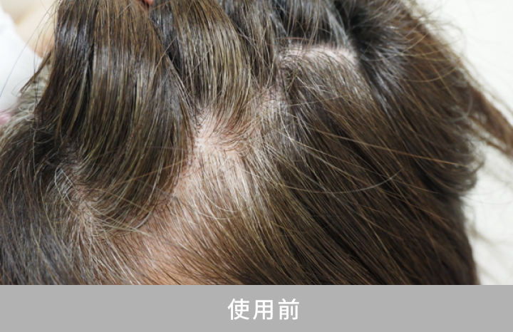 使用前