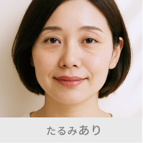 たるみあり