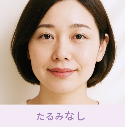 たるみなし