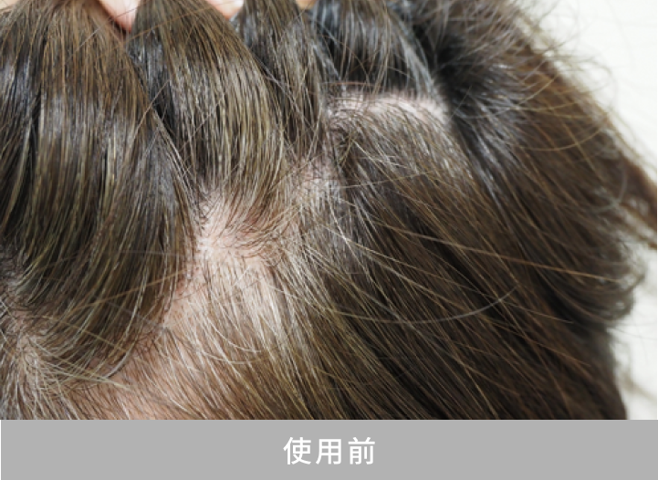 使用前