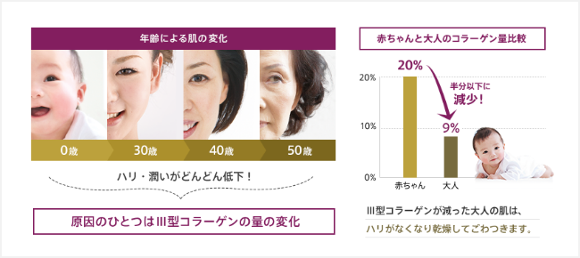 年齢による肌の変化  0歳  30歳  40歳  50歳  ハリ・潤いがどんどん低下！  原因のひとつはⅢ型コラーゲンの量の変化  赤ちゃんと大人のコラーゲン量比較  20% → 9%  半分以下に減少！  Ⅲ型コラーゲンが減った大人の肌は、ハリがなくなり乾燥してごわつきます。