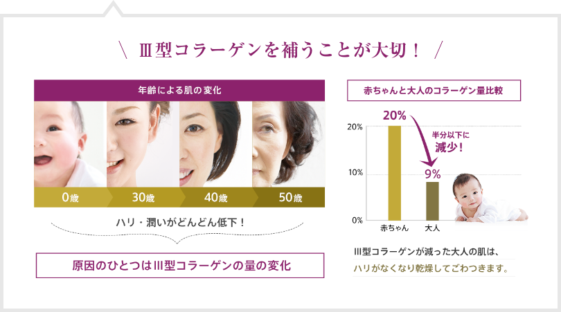 Ⅲ型コラーゲンを補うことが大切！  年齢による肌の変化  0歳  30歳  40歳  50歳  ハリ・潤いがどんどん低下！  原因のひとつはⅢ型コラーゲンの量の変化  赤ちゃんと大人のコラーゲン量比較  20% → 9%  半分以下に減少！  Ⅲ型コラーゲンが減った大人の肌は、ハリがなくなり乾燥してごわつきます。