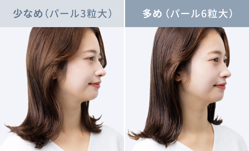 少なめ（パール3粒大）  多め（パール6粒大）