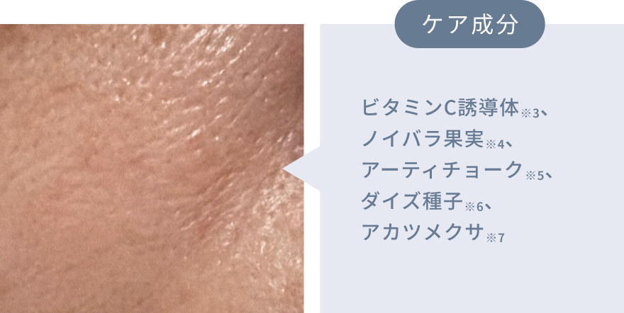 ケア成分 ビタミンC誘導体※3、ノイバラ果実※4、アーティチョーク※5、ダイズ種子※6、アカツメクサ※7