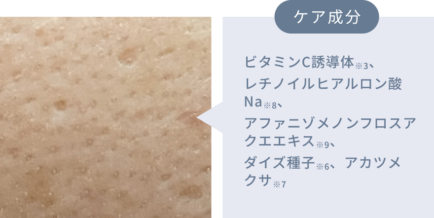 ケア成分 ビタミンC誘導体※3、レチノイルヒアルロン酸Na※8、アファニゾメノンフロスアクエエキス※9、ダイズ種子※6、アカツメクサ※7