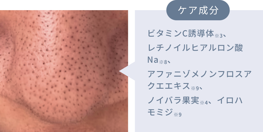 ケア成分 ビタミンC誘導体※3、レチノイルヒアルロン酸Na※8、アファニゾメノンフロスアクエエキス※9、ノイバラ果実※4、イロハモミジ※9