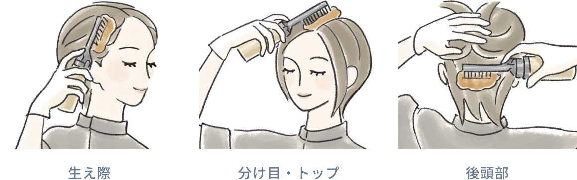 生え際 分け目・トップ 後頭部