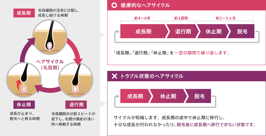 ヘアサイクル（毛周期） 成長期 毛母細胞が活発に分裂し、成長し続ける時期 休止期 成長が止まり、脱毛へと移る時期 退行期 毛母細胞の分裂スピードが低下し、毛根が頭皮の浅い所へ移動する時期 〇 健康的なヘアサイクル 約4～6年 成長期 約3週間 退行期 約3～5ヵ月 休止期 脱毛 「成長期」「退行期」「休止期」を一定の期間で繰り返します。 × トラブル状態のヘアサイクル 成長期 休止期 脱毛 サイクルが短縮します。成長期の途中で休止期に移行し、十分な成長が行われなかったり、脱毛後に成長期へ移行できない状態です。