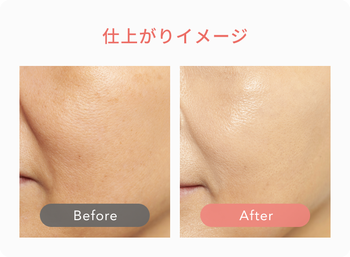 仕上がりイメージ  Before  After