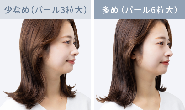 少なめ(パール3粒大) 多め(パール6粒大)