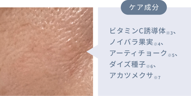 ケア成分  ビタミンC誘導体※3、ノイバラ果実※4、アーティチョーク※5、ダイズ種子※6、アカツメクサ※7