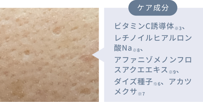 ケア成分  ビタミンC誘導体※3、レチノイルヒアルロン酸Na※8、アファニゾメノンフロスアクエエキス※9、ダイズ種子※6、アカツメクサ※7