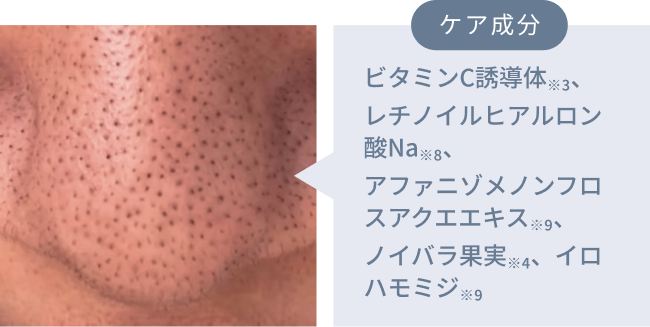 ケア成分  ビタミンC誘導体※3、レチノイルヒアルロン酸Na※8、アファニゾメノンフロスアクエエキス※9、ノイバラ果実※4、イロハモミジ※9