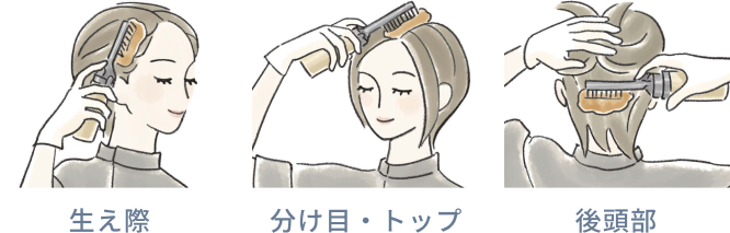 生え際 分け目・トップ 後頭部